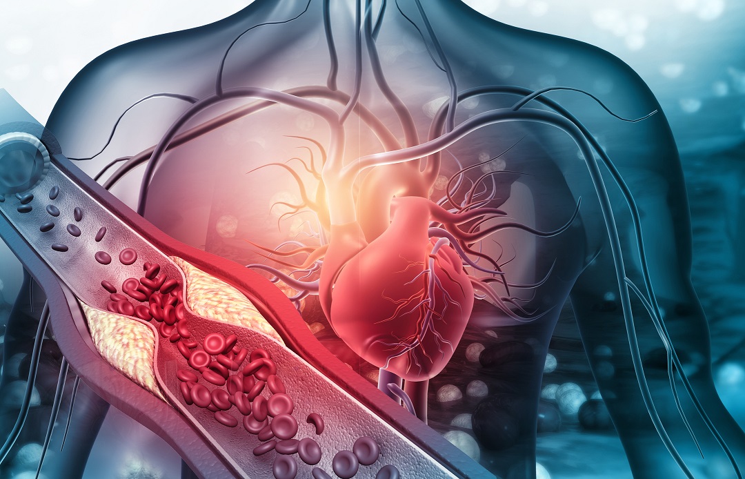 preventie-boli-cardiovasculare